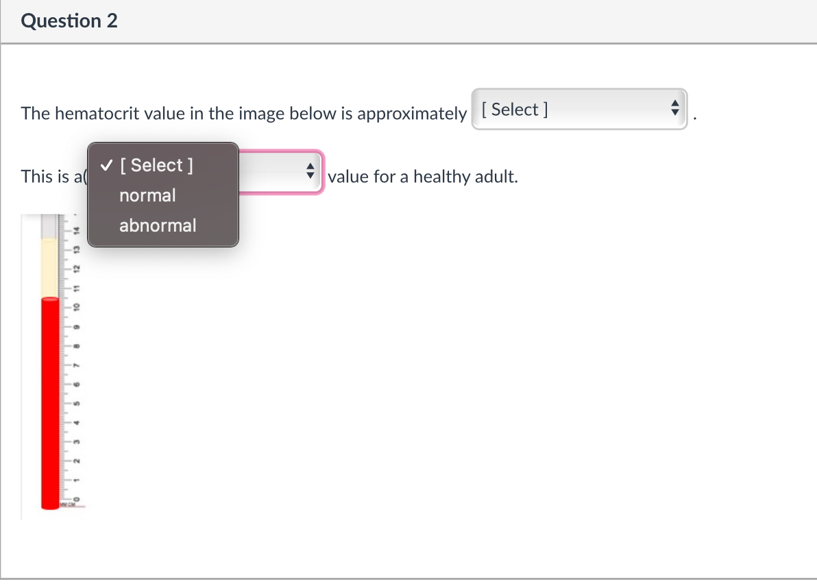 Question 2
The hematocrit value in the image below is approximately [ Select ]
v [ Select ]
This is a
value for a healthy adult.
normal
abnormal
