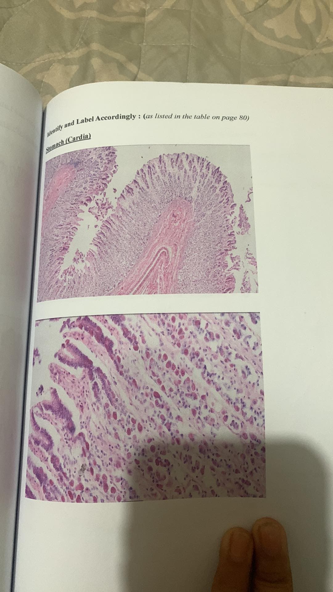 Identify and Label Accordingly: (as listed in the table on page 80)
Stomach
(Cardia)