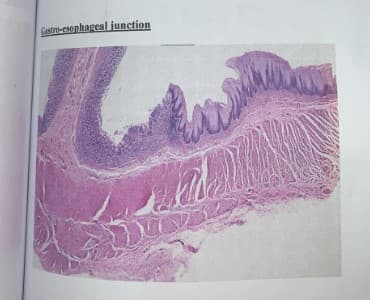 Gastro-esophageal junction
sa