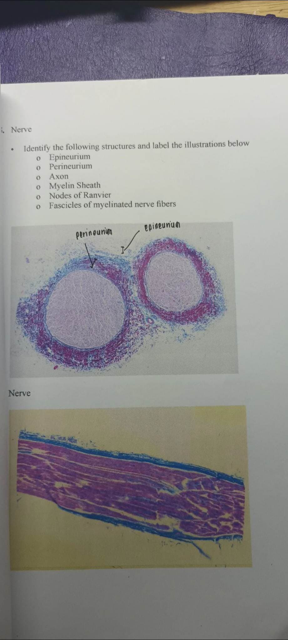 i. Nerve
Identify the following structures and label the illustrations below
o Epineurium
0
Perineurium
Nerve
0
Axon
o Myelin Sheath
0
0
Nodes of Ranvier
Fascicles of myelinated nerve fibers
epineunium
perineunum
00