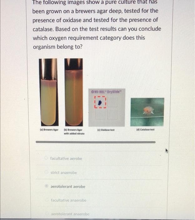 The following images show a pure culture that has
been grown on a brewers agar deep, tested for the
presence of oxidase and tested for the presence of
catalase. Based on the test results can you conclude
which oxygen requirement category does this
organism belong to?
OD BEL Drysde
a) Brewen Agar Brewers Agar
d Oaidane test
4 Catalase test
with added nitrate
facultative aerobe
strict anaerobe
aerotolerant aerobe
facultative anaerobe
aerotolerant anaerobe
