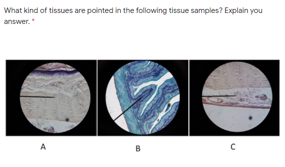 What kind of tissues are pointed in the following tissue samples? Explain you
answer. *
A
