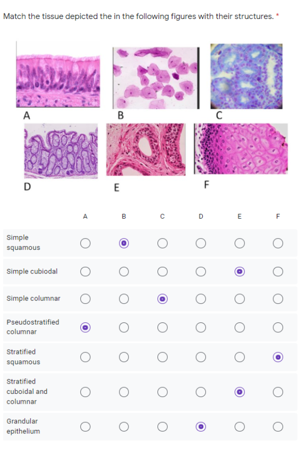 Match the tissue depicted the in the following figures with their structures. *
A
B
D
E
F
A
D
E
F
Simple
squamous
Simple cubiodal
Simple columnar
Pseudostratified
columnar
Stratified
squamous
Stratified
cuboidal and
columnar
Grandular
epithelium
C.
B.
