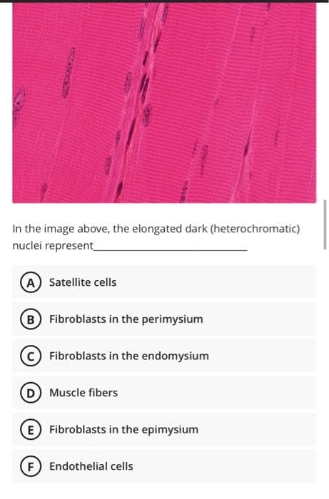 In the image above, the elongated dark (heterochromatic)
nuclei represent
A Satellite cells
B Fibroblasts in the perimysium
Fibroblasts in the endomysium
Muscle fibers
E Fibroblasts in the epimysium
F) Endothelial cells

