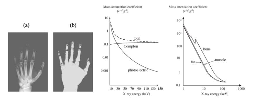 Mass attenuation coefficient
(cm'g)
Mass attenuation coefficient
(em'g")
104
(a)
(b)
10
total
0.1
Compton
100
bone
0.01
10
muscle
fat
0.001
photoelectric
0.1
10 30 50 70 90 110 130 150
10
100
1000
Х-гау energy (keV)
Х-аy energy (keV)
