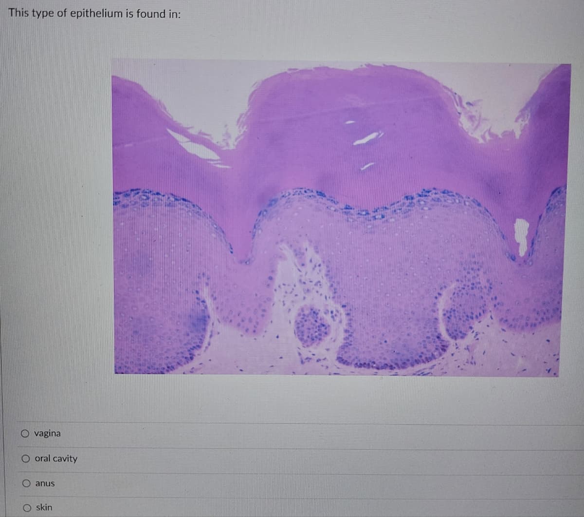 This type of epithelium is found in:
O vagina
O oral cavity
anus
O skin