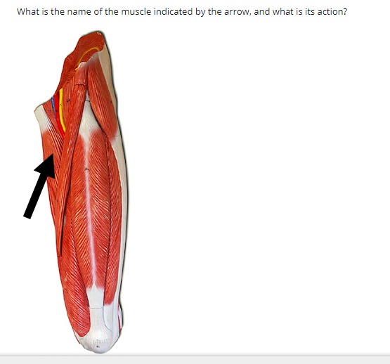 What is the name of the muscle indicated by the arrow, and what is its action?

