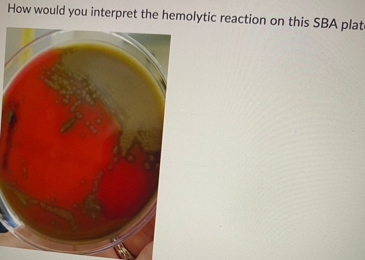 How would you interpret the hemolytic reaction on this SBA plate
