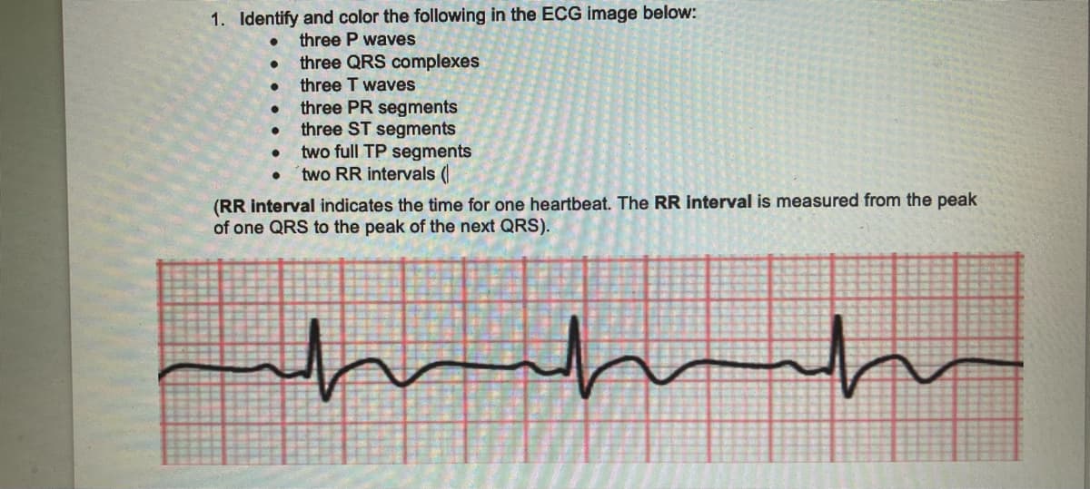 1. Identify and color the following in the ECG image below:
three P waves
three QRS complexes
three T waves
three PR segments
three ST segments
two full TP segments
two RR intervals (
●
●
●
●
(RR interval indicates the time for one heartbeat. The RR interval is measured from the peak
of one QRS to the peak of the next QRS).
h
h