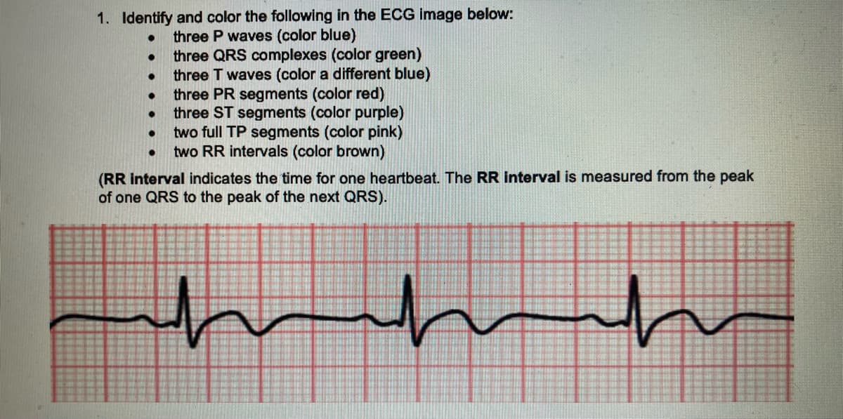 1. Identify and color the following in the ECG image below:
●
three P waves (color blue)
●
●
●
●
three QRS complexes (color green)
three T waves (color a different blue)
three PR segments (color red)
three ST segments (color purple)
two full TP segments (color pink)
two RR intervals (color brown)
(RR interval indicates the time for one heartbeat. The RR interval is measured from the peak
of one QRS to the peak of the next QRS).
ملله