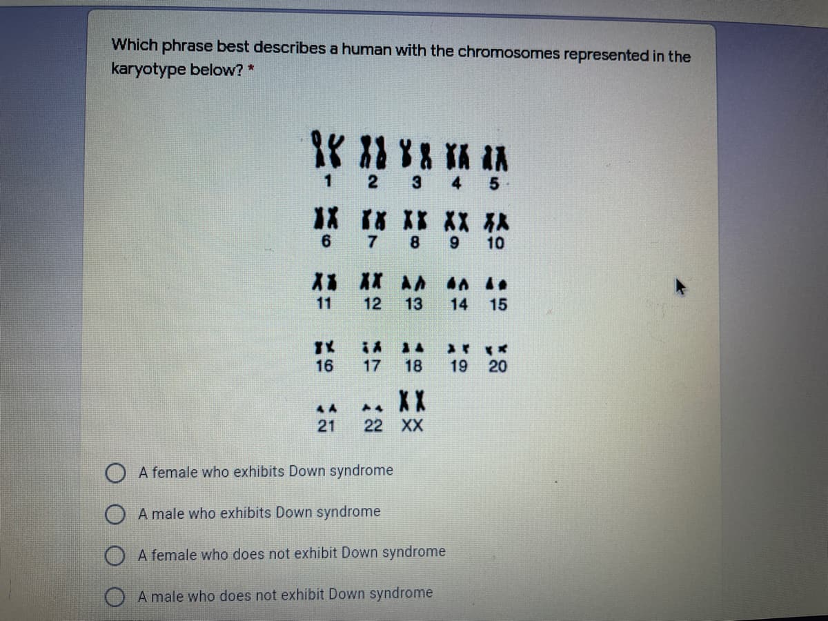 Which phrase best describes a human with the chromosomes represented in the
karyotype below? *
1
3
5
1X rs XX XX 从
10
11
12
13
14
15
16
17
18
19
20
XX
4 A
21
22 XX
A female who exhibits Down syndrome
O A male who exhibits Down syndrome
A female who does not exhibit Down syndrome
A male who does not exhibit Down syndrome
