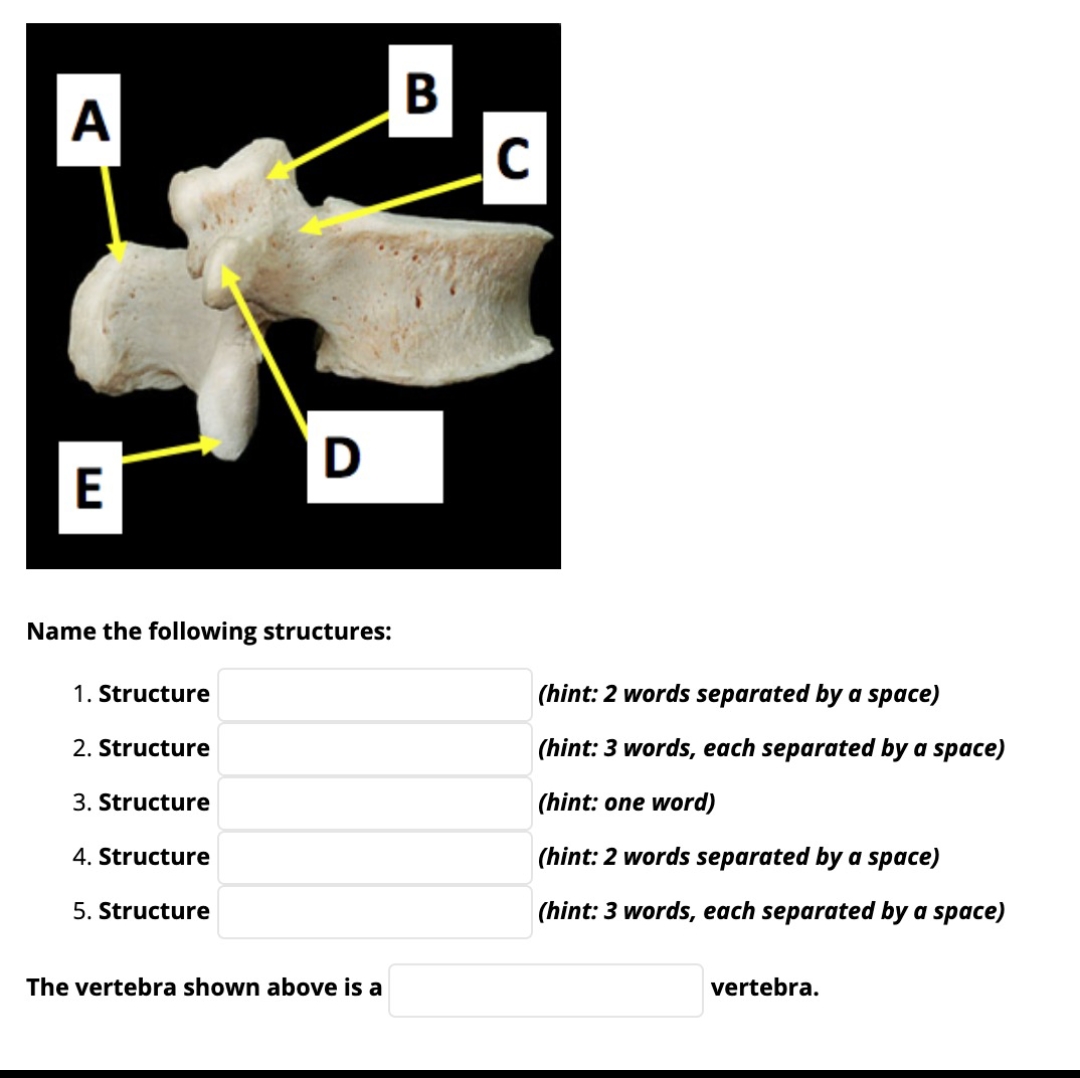 A
E
Name the following structures:
1. Structure
2. Structure
3. Structure
4. Structure
D
5. Structure
The vertebra shown above is a
B
C
(hint: 2 words separated by a space)
(hint: 3 words, each separated by a space)
(hint: one word)
(hint: 2 words separated by a space)
(hint: 3 words, each separated by a space)
vertebra.
