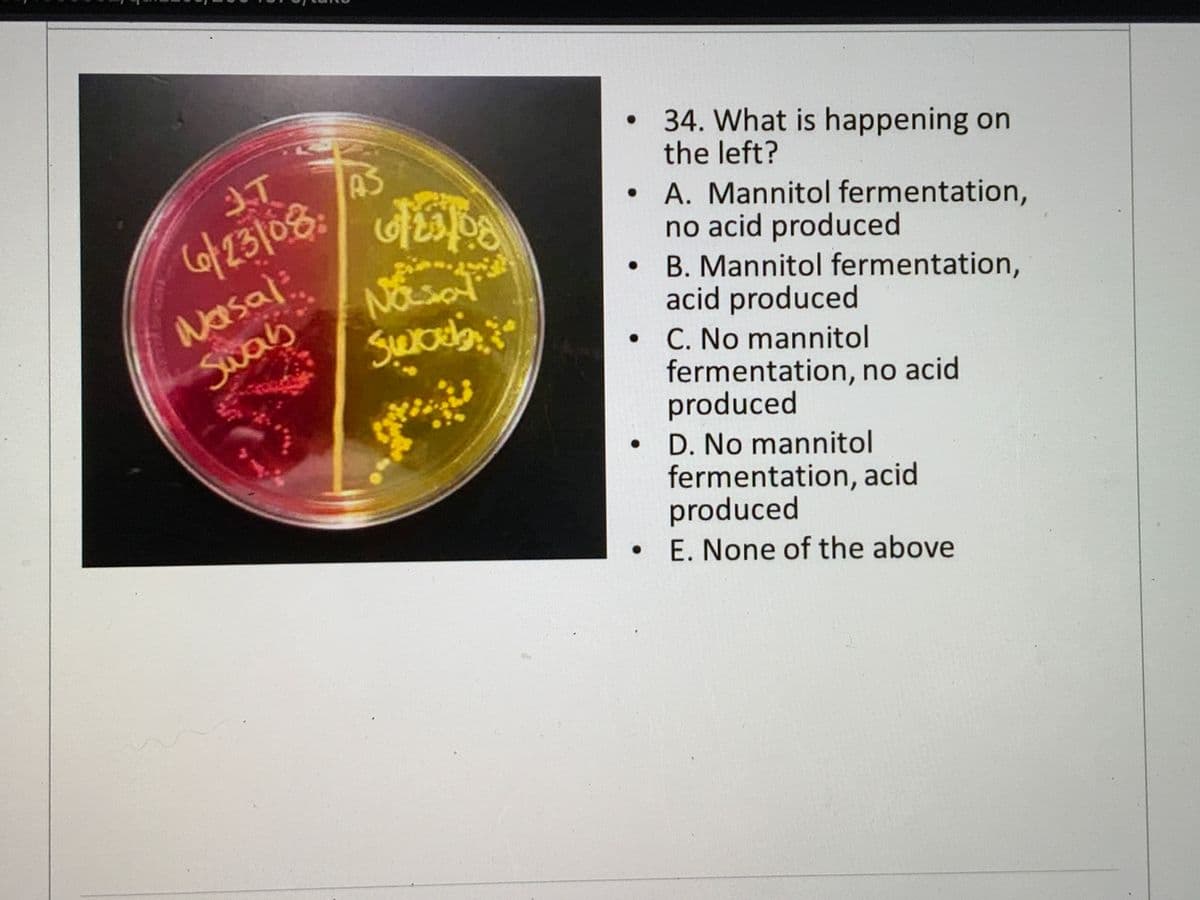 34. What is happening on
the left?
AS
• A. Mannitol fermentation,
no acid produced
B. Mannitol fermentation,
acid produced
• C. No mannitol
fermentation, no acid
produced
D. No mannitol
fermentation, acid
produced
E. None of the above
Co/23108:
Nasal:
Swas
