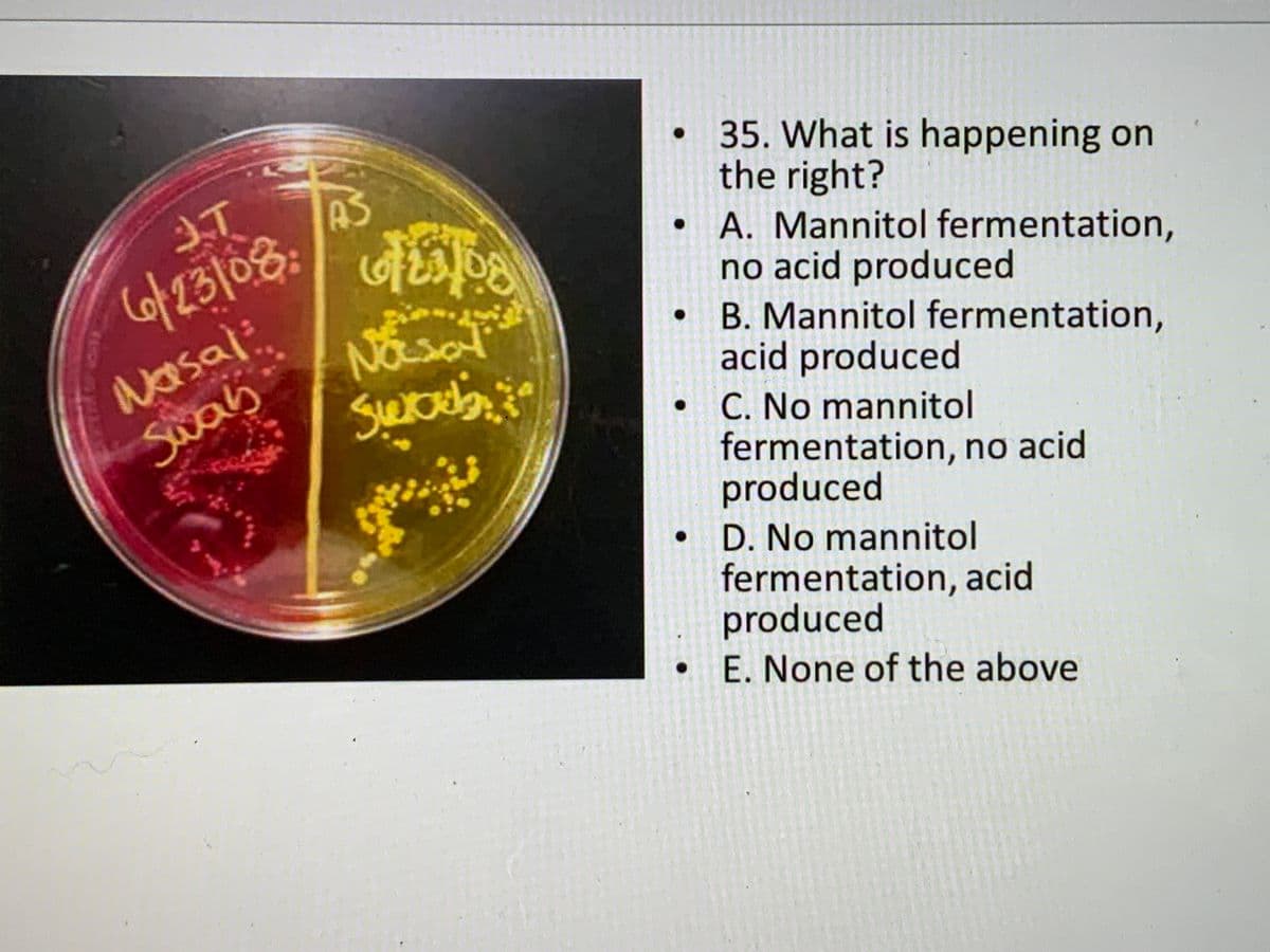 35. What is happening on
the right?
• A. Mannitol fermentation,
no acid produced
B. Mannitol fermentation,
acid produced
• C. No mannitol
fermentation, no acid
produced
3T
AS
Cof23108:
Nasal
Swas
D. No mannitol
fermentation, acid
produced
E. None of the above
