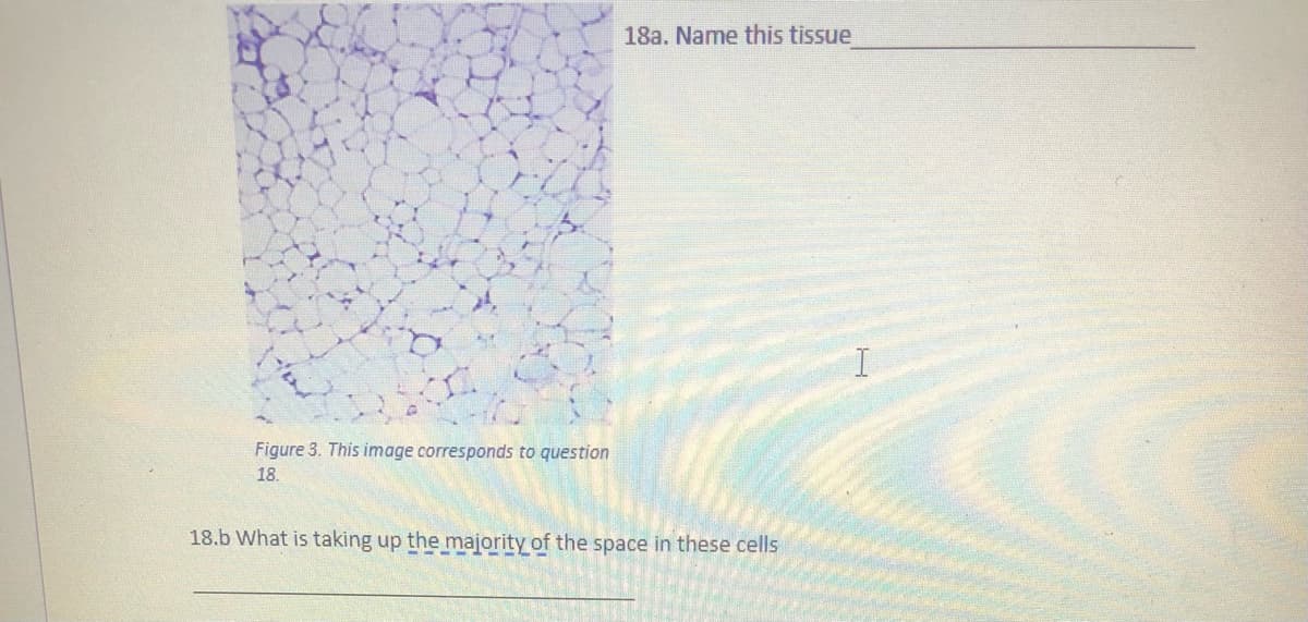 18a. Name this tissue
Figure 3. This image corresponds to question
18.
18.b What is taking up the majority of the space in these cells

