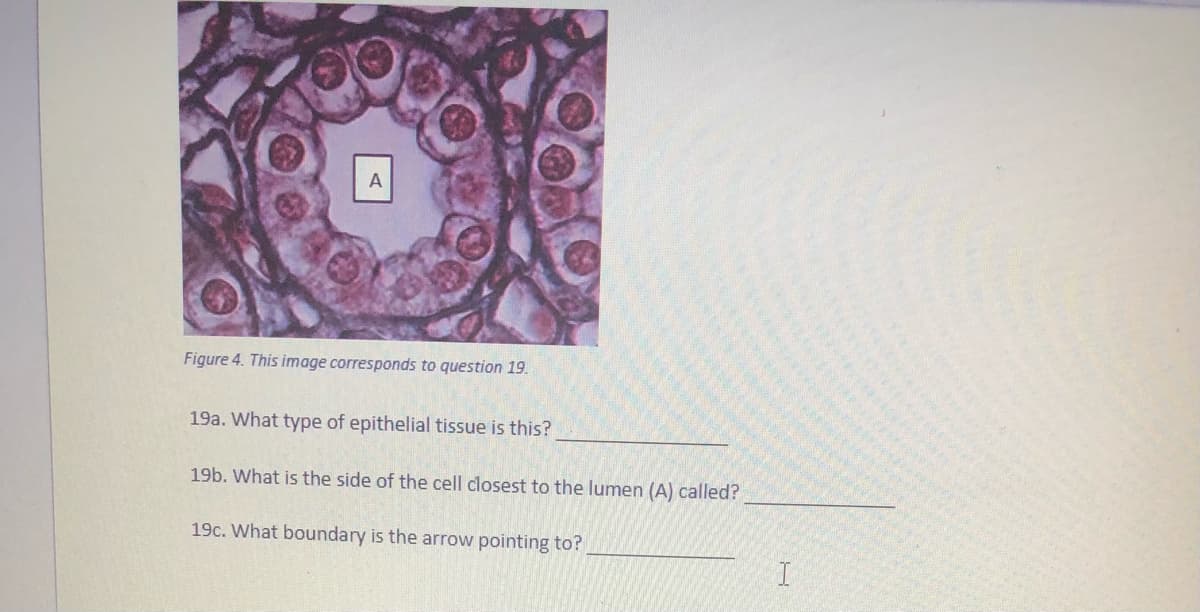 A
Figure 4. This image corresponds to question 19.
19a. What type of epithelial tissue is this?
19b. What is the side of the cell closest to the lumen (A) called?
19c. What boundary is the arrow pointing to?
