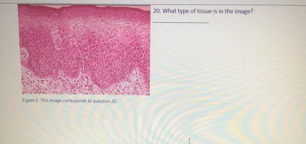 20. What type of tissue is in the image?
Figure 5. This image corresponds to question 20.

