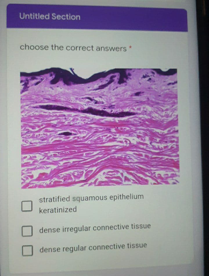 Untitled Section
choose the correct answers
stratified squamous epithelium
keratinized
dense irregular connective tissue
dense regular connective tissue
