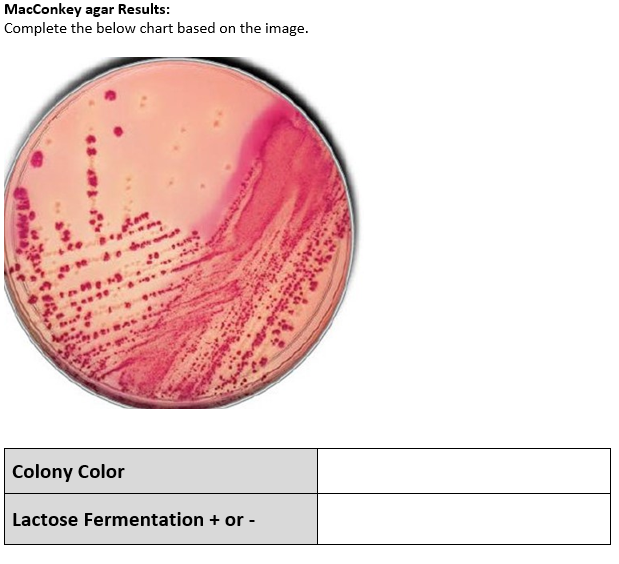MacConkey agar Results:
Complete the below chart based on the image.
****
to
TAREM..
MANGE B
and pr
ARAS
FURR
Colony Color
Lactose Fermentation + or -