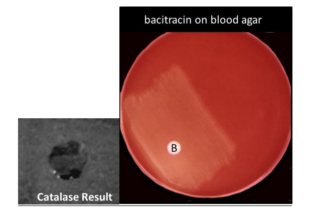 Catalase Result
bacitracin on blood agar
B