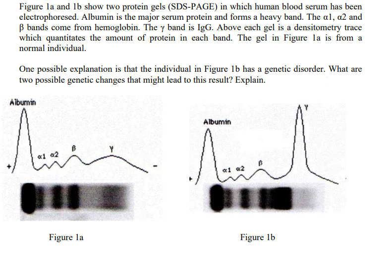 Figure la and lb show two protein gels (SDS-PAGE) in which human blood serum has been
electrophoresed. Albumin is the major serum protein and forms a heavy band. The al, a2 and
B bands come from hemoglobin. The y band is IgG. Above each gel is a densitometry trace
which quantitates the amount of protein in each band. The gel in Figure la is from a
normal individual.
One possible explanation is that the individual in Figure 1b has a genetic disorder. What are
two possible genetic changes that might lead to this result? Explain.
Albumin
Albumin
«1 a2
a1 a2
Figure la
Figure 1b
