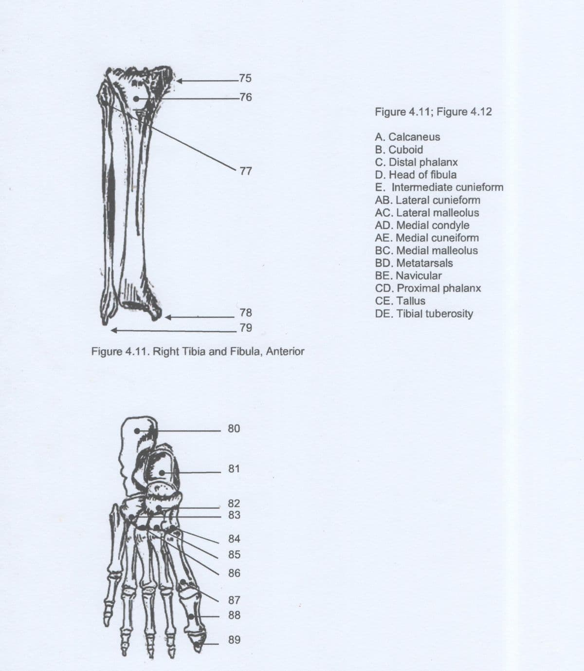 .75
-76
Figure 4.11; Figure 4.12
A. Calcaneus
B. Cuboid
C. Distal phalanx
D. Head of fibula
E. Intermediate cunieform
AB. Lateral cunieform
AC. Lateral malleolus
77
AD. Medial condyle
AE. Medial cuneiform
BC. Medial malleolus
BD. Metatarsals
BE. Navicular
CD. Proximal phalanx
CE. Tallus
78
DE. Tibial tuberosity
79
Figure 4.11. Right Tibia and Fibula, Anterior
80
81
82
83
84
85
86
87
88
89

