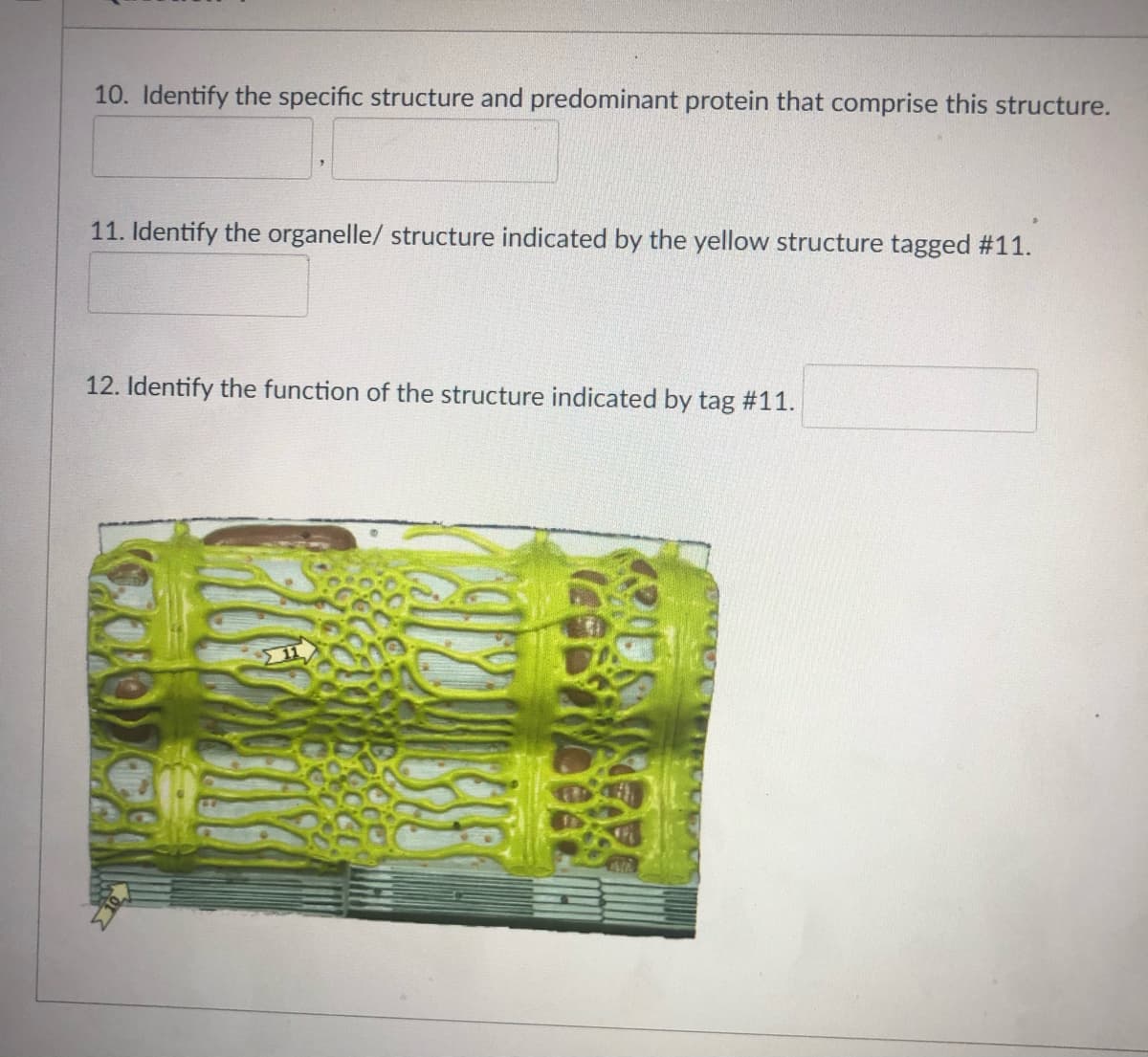 10. Identify the specific structure and predominant protein that comprise this structure.
11. Identify the organelle/ structure indicated by the yellow structure tagged #11.
12. Identify the function of the structure indicated by tag #11.
ΣΤ
