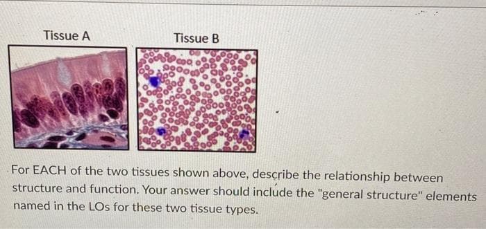 Tissue A
Do
0%
Tissue B
For EACH of the two tissues shown above, describe the relationship between
structure and function. Your answer should include the "general structure" elements
named in the LOs for these two tissue types.
