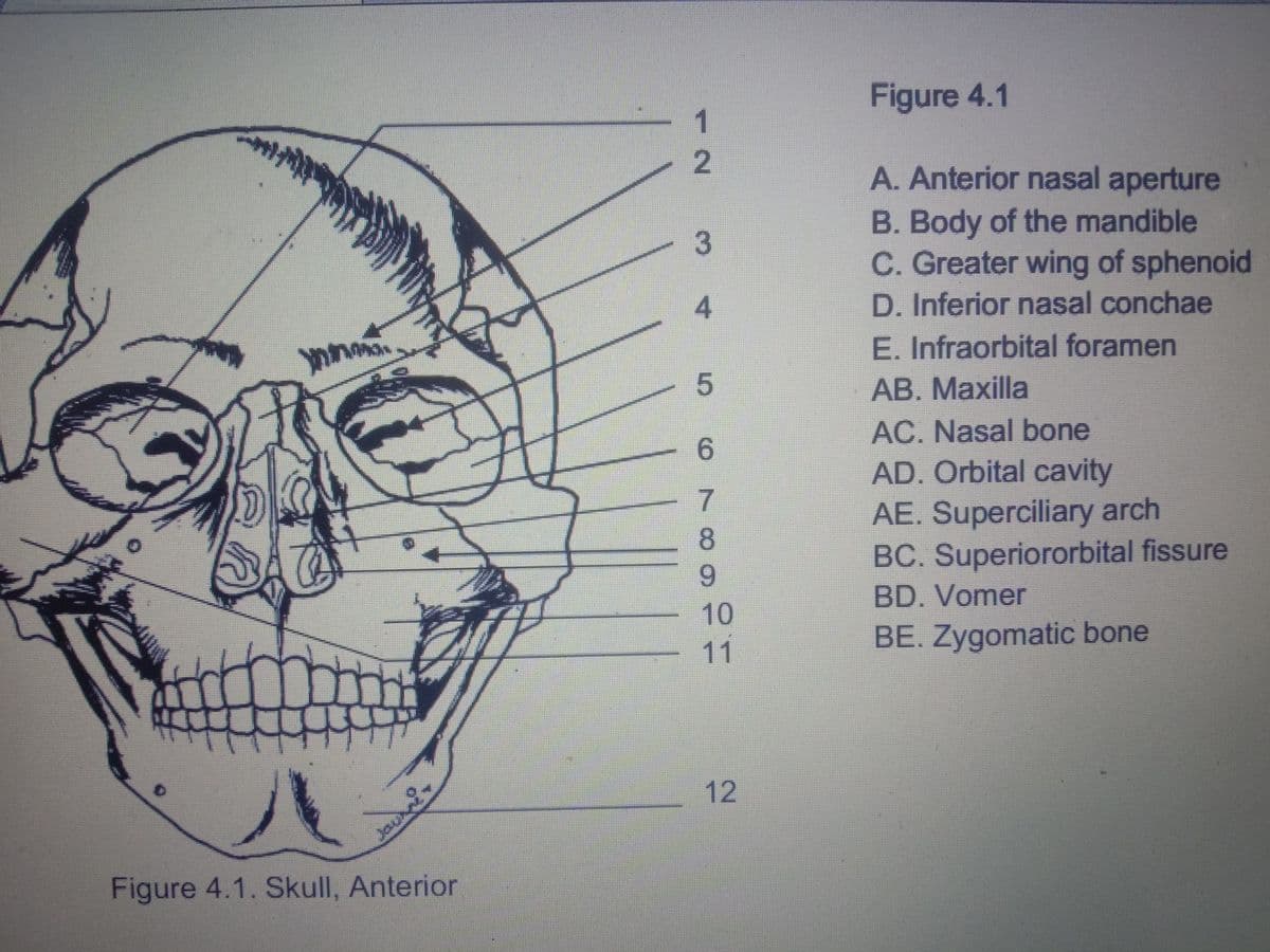 Figure 4.1
1.
- 2
A. Anterior nasal aperture
B. Body of the mandible
C. Greater wing of sphenoid
3
4.
D. Inferior nasal conchae
E. Infraorbital foramen
AB. Maxilla
AC. Nasal bone
6.
AD. Orbital cavity
7.
AE. Superciliary arch
BC. Superiororbital fissure
8.
6.
BD. Vomer
10
11
BE. Zygomatic bone
ハ
12
Figure 4.1. Skull, Anterior
Jaunne.
