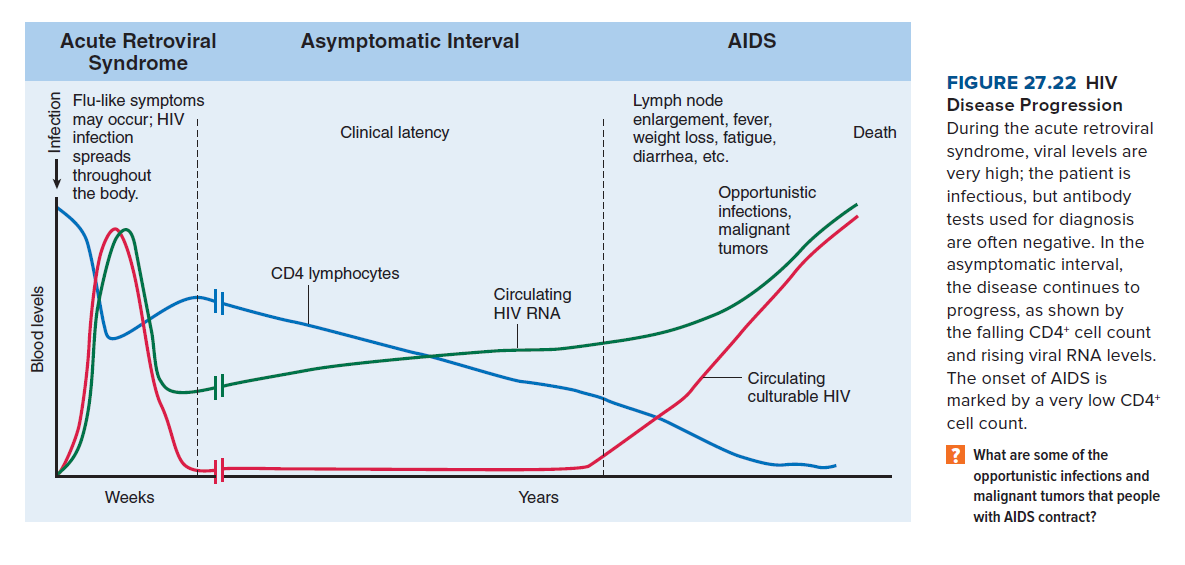 Acute Retroviral
Asymptomatic Interval
AIDS
Syndrome
FIGURE 27.22 HIV
Flu-like symptoms
Lymph node
enlargement, fever,
weight loss, fatigue,
diarrhea, etc.
Disease Progression
may occur; HIV
infection
spreads
throughout
the body.
Clinical latency
Death
During the acute retroviral
syndrome, viral levels are
very high; the patient is
Opportunistic
infections,
malignant
tumors
infectious, but antibody
tests used for diagnosis
are often negative. In the
asymptomatic interval,
the disease continues to
CD4 lymphocytes
Circulating
HIV RNA
progress, as shown by
the falling CD4* cell count
and rising viral RNA levels.
The onset of AIDS is
Circulating
culturable HIV
marked by a very low CD4+
cell count.
? What are some of the
opportunistic infections and
malignant tumors that people
Weeks
Years
with AIDS contract?
Blood levels
+Infection
