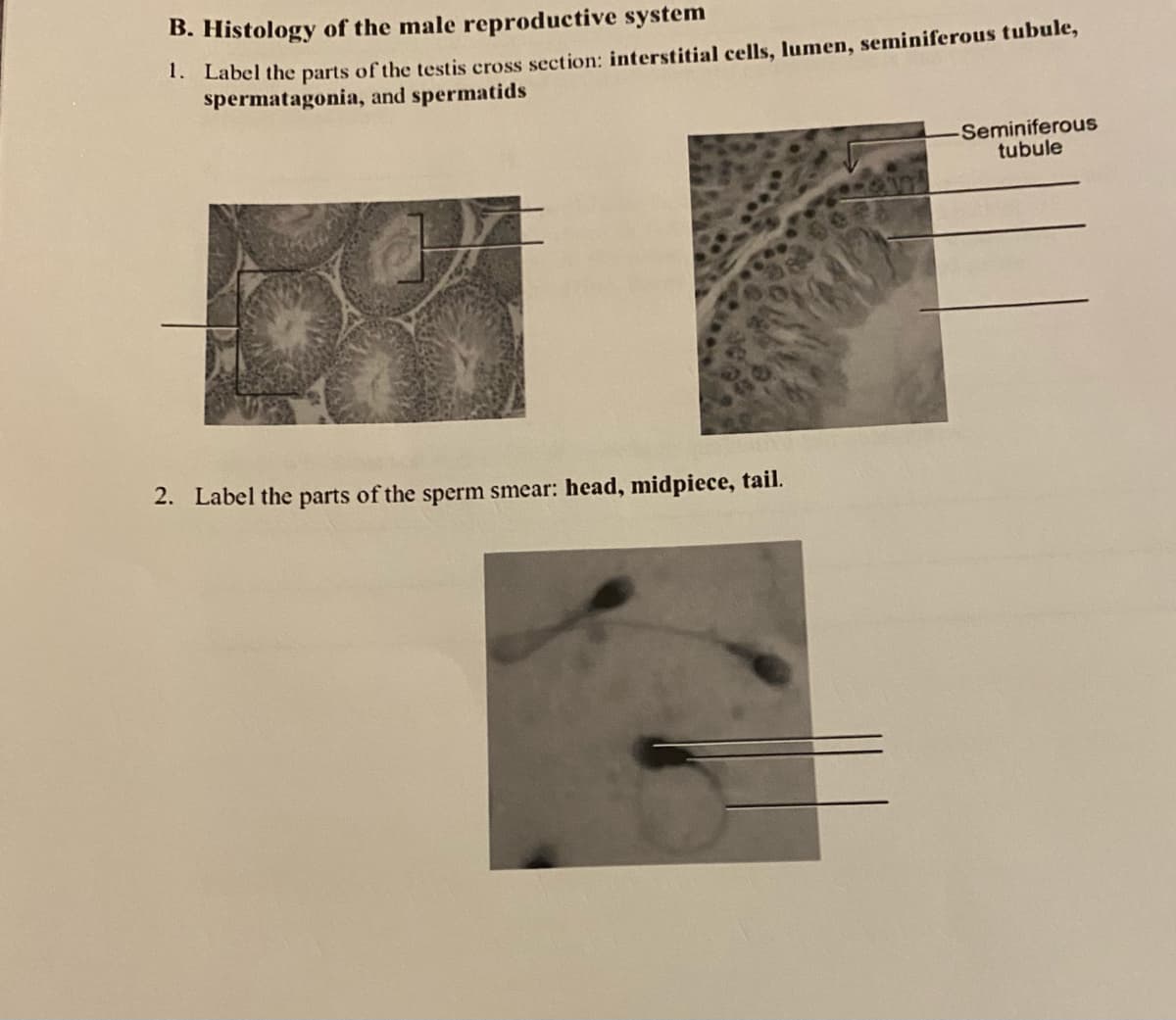 B. Histology of the male reproductive system
1. Label the parts of the testis cross section: interstitial cells, lumen, seminiferous tubule,
spermatagonia, and spermatids
Seminiferous
tubule
2. Label the parts of the sperm smear: head, midpiece, tail.
