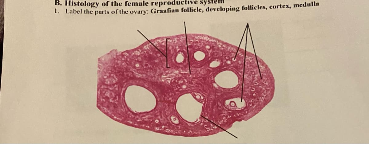 B. Histology of the female reproductive system
. Label the parts of the ovary: Graafian follicle, developing follicles, cortex, medulla
