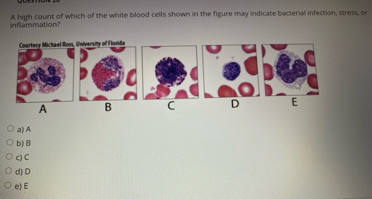 A high count of which of the white blood cells shown in the figure may indicate bacterial infection, stress, or
inflammation?
Courtesy Michael Ross, University of Florida
D
A
a) A
O b) B
d) D
O e) E
