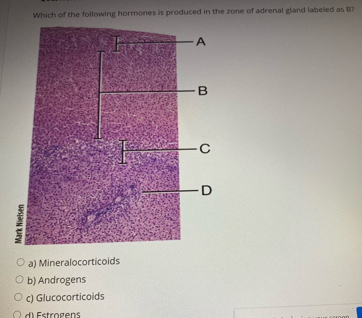 Which of the following hormones is produced in the zone of adrenal gland labeled as B?
D
O a) Mineralocorticoids
O b) Androgens
O c) Glucocorticoids
O d) Estrogens
croen
Mark Nielsen
