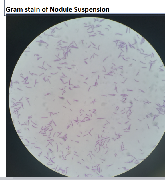 Gram stain of Nodule Suspension
