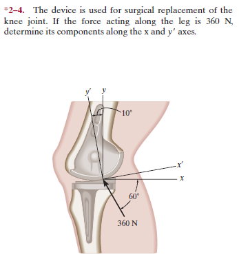 *2-4. The device is used for surgical replacement of the
knee joint. If the force acting along the leg is 360 N,
determine its components along the x and y' axes.
10°
х
60°
360 N

