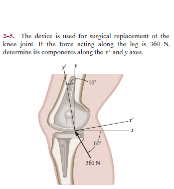 2-5. The device is used for surgical replacement of the
knee joint. If the force acting along the leg is 360 N,
determine its components along the x' and y axes.
10°
х
60°
360 N
