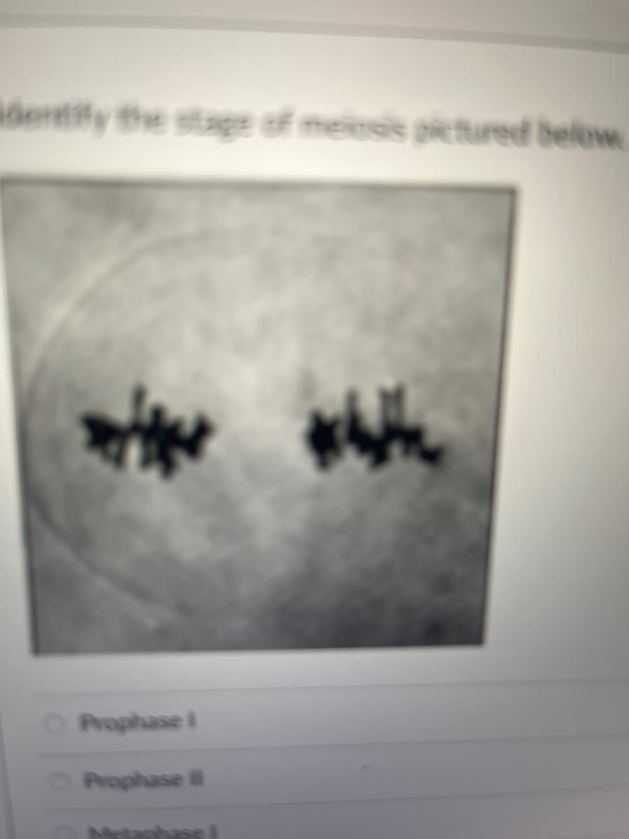 identify the stage of melcsis pictured below
Prophase I
Prophase II