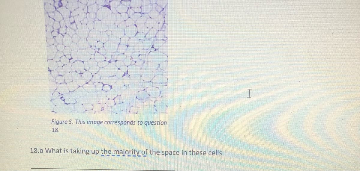 I
Figure 3. This image corresponds to question
18.
18.b What is taking up the majority of the space in these cells
