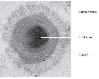 Surface fibrils
DNA core
Capsid
