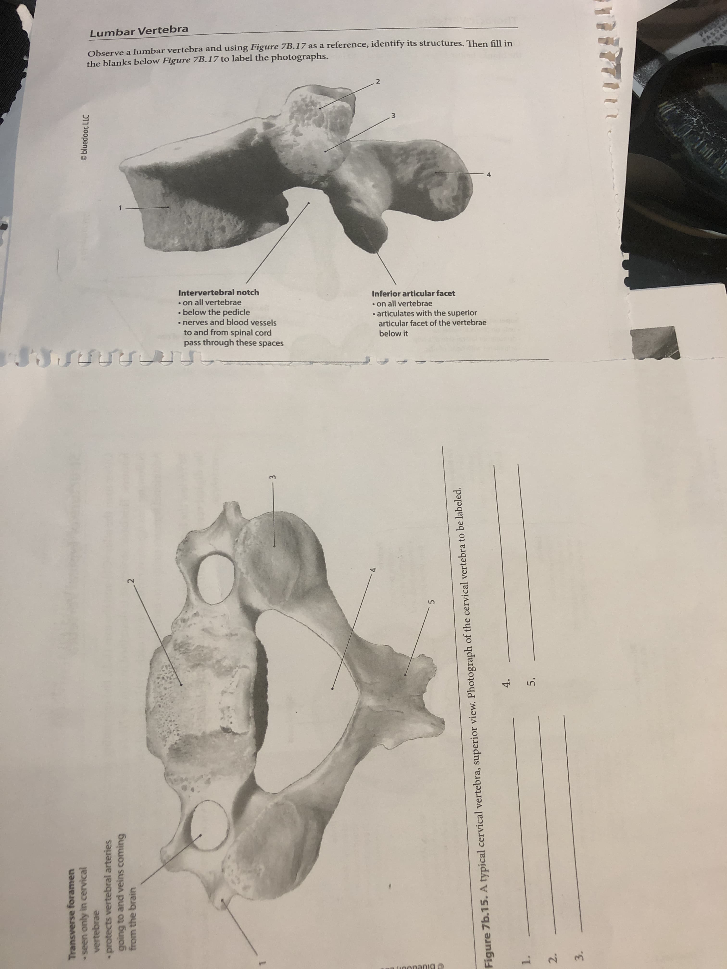 Lumbar Vertebra
Observe a lumbar vertebra and using Figure 7B.17 as a reference, identify its structures. Then fill in
the blanks below Figure 7B.17 to label the photographs.
PASSPO
ASAR
4
Intervertebral notch
• on all vertebrae
below the pedicle
• nerves and blood vessels
to and from spinal cord
pass through these spaces
Inferior articular facet
• on all vertebrae
• articulates with the superior
articular facet of the vertebrae
below it
3.
4.
tioonanig
2.
Transverse foramen
seen only in cervical
vertebrae
O bluedoor, LLC
protects vertebral arteries
going to and veins coming
from the brain
4.
5.
Figure 7b.15. A typical cervical vertebra, superior view. Photograph of the cervical vertebra to be labeled.
1.
5.
3.
