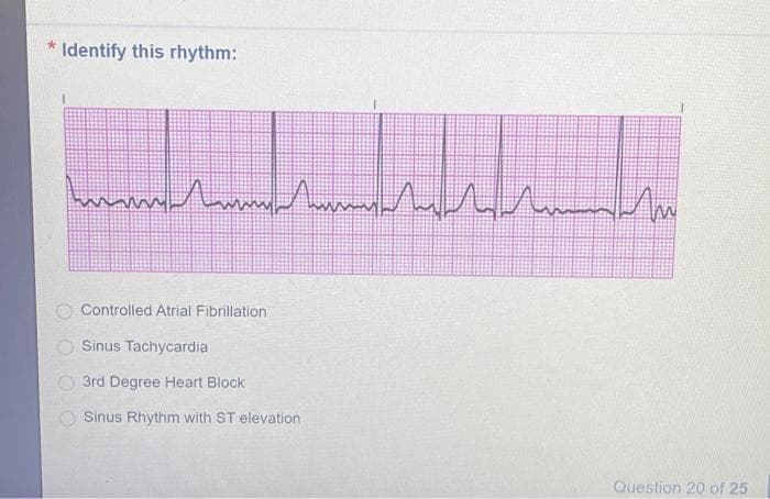* Identify this rhythm:
Чили Лити Лити ли или ли
Controlled Atrial Fibrillation
Sinus Tachycardia
3rd Degree Heart Block
Sinus Rhythm with ST elevation
Question 20 of 25