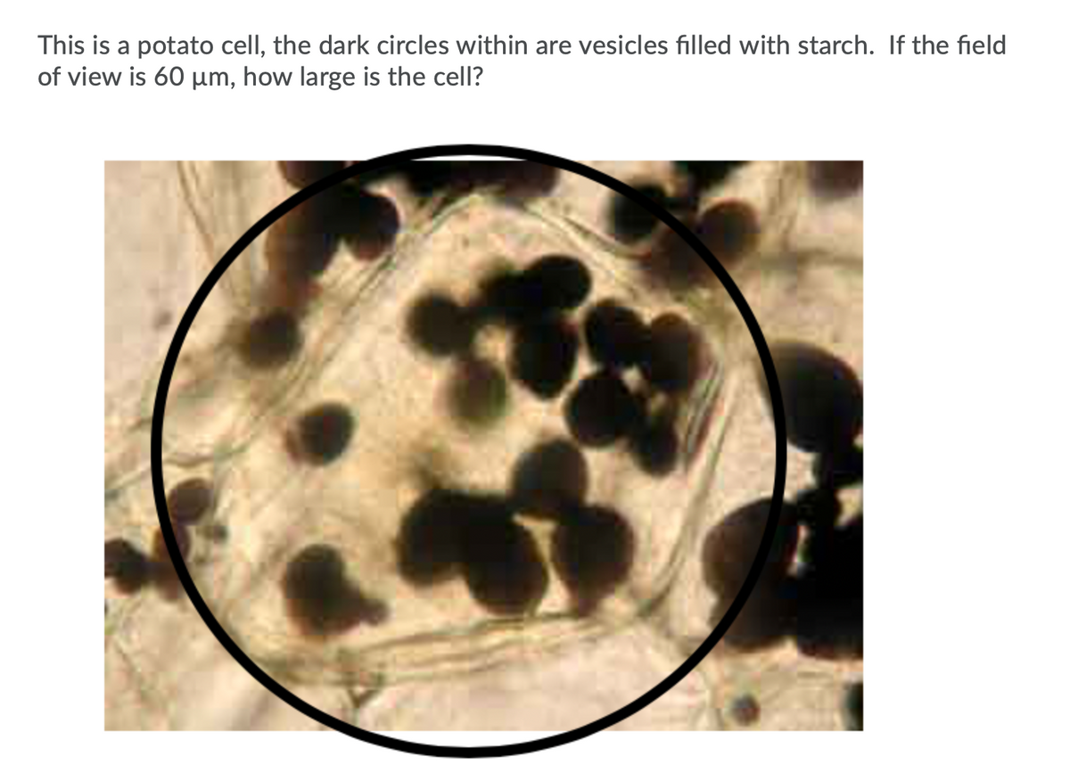 This is a potato cell, the dark circles within are vesicles filled with starch. If the field
of view is 60 µm, how large is the cell?
