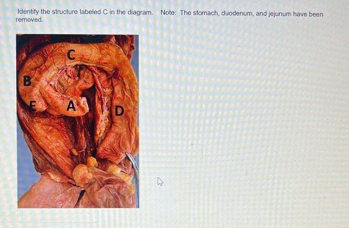 Identify the structure labeled C in the diagram. Note: The stomach, duodenum, and jejunum have been
removed.
B
A
D
ہے