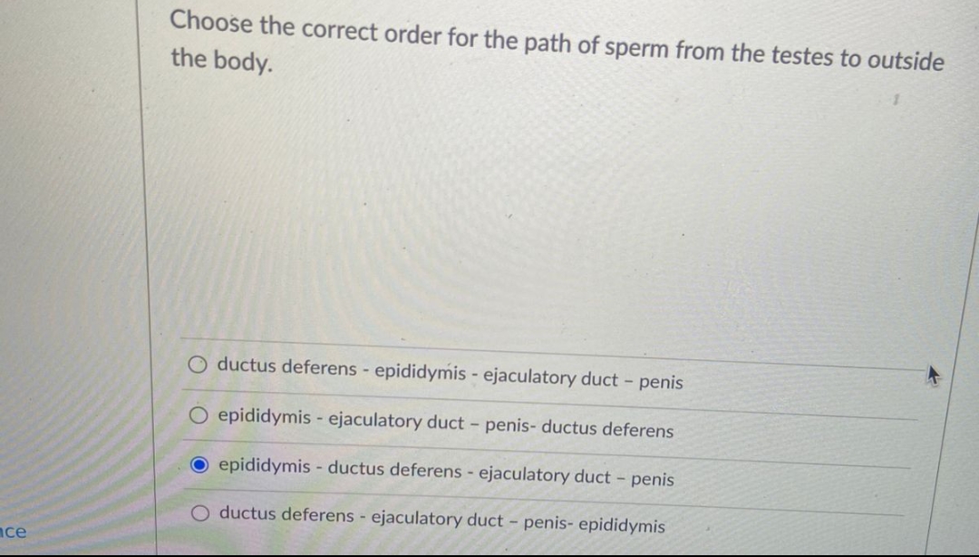 ace
Choose the correct order for the path of sperm from the testes to outside
the body.
O ductus deferens - epididymis - ejaculatory duct - penis
O epididymis - ejaculatory duct - penis- ductus deferens
O epididymis- ductus deferens - ejaculatory duct - penis
O ductus deferens - ejaculatory duct - penis- epididymis