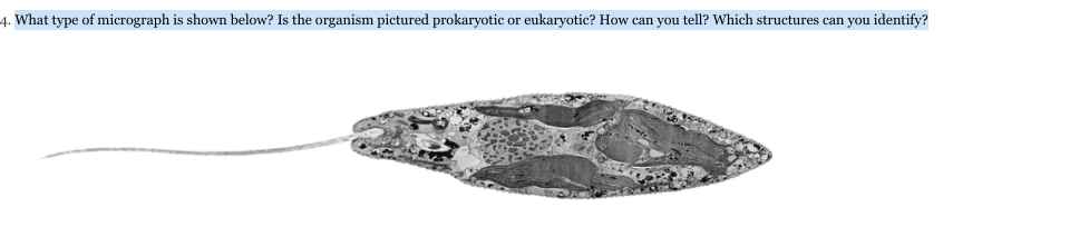 4. What type of micrograph is shown below? Is the organism pictured prokaryotic or eukaryotic? How can you tell? Which structures can you identify?
