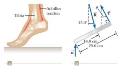 -Achilles
tendon
Tibia
15.0
18.0 cm
25.0 cm
