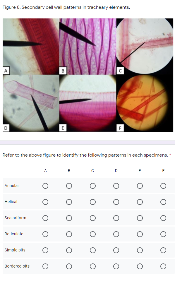 Figure 8. Secondary cell wall patterns in tracheary elements.
A
D
E
F
Refer to the above figure to identify the following patterns in each specimens. *
A
В
D
E
F
Annular
Helical
Scalariform
Reticulate
Simple pits
Bordered oits
