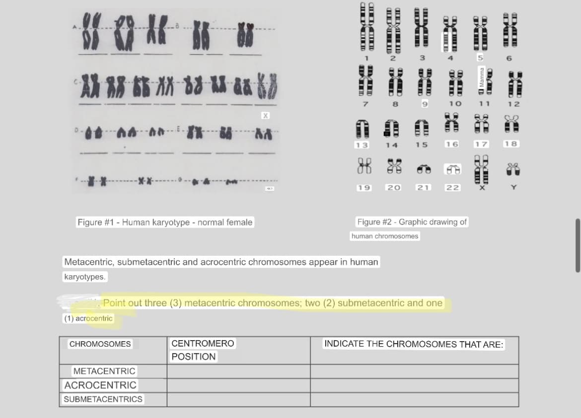 WOMEH B
AN--
D.
d8Dt htt
Figure #1 - Human karyotype - normal female|
(1) acrocentric
CHROMOSOMES
Hம்
METACENTRIC
ACROCENTRIC
SUBMETACENTRICS
II மம்
MIID
Metacentric, submetacentric and acrocentric chromosomes appear in human
karyotypes.
CENTROMERO
POSITION
13
19
டேயாடம்ம
CHEMIID
14
20
மனம்
ITNN
* Point out three (3) metacentric chromosomes; two (2) submetacentric and one
15
ம்
ரயம
ரன
ம
21 22
Figure #2 - Graphic drawing of
human chromosomes
THIRD
சும்
Mamma
-ம
TOD
5
D
TID
III.
ம்
ID
INDICATE THE CHROMOSOMES THAT ARE:
AT
N
SC
➤