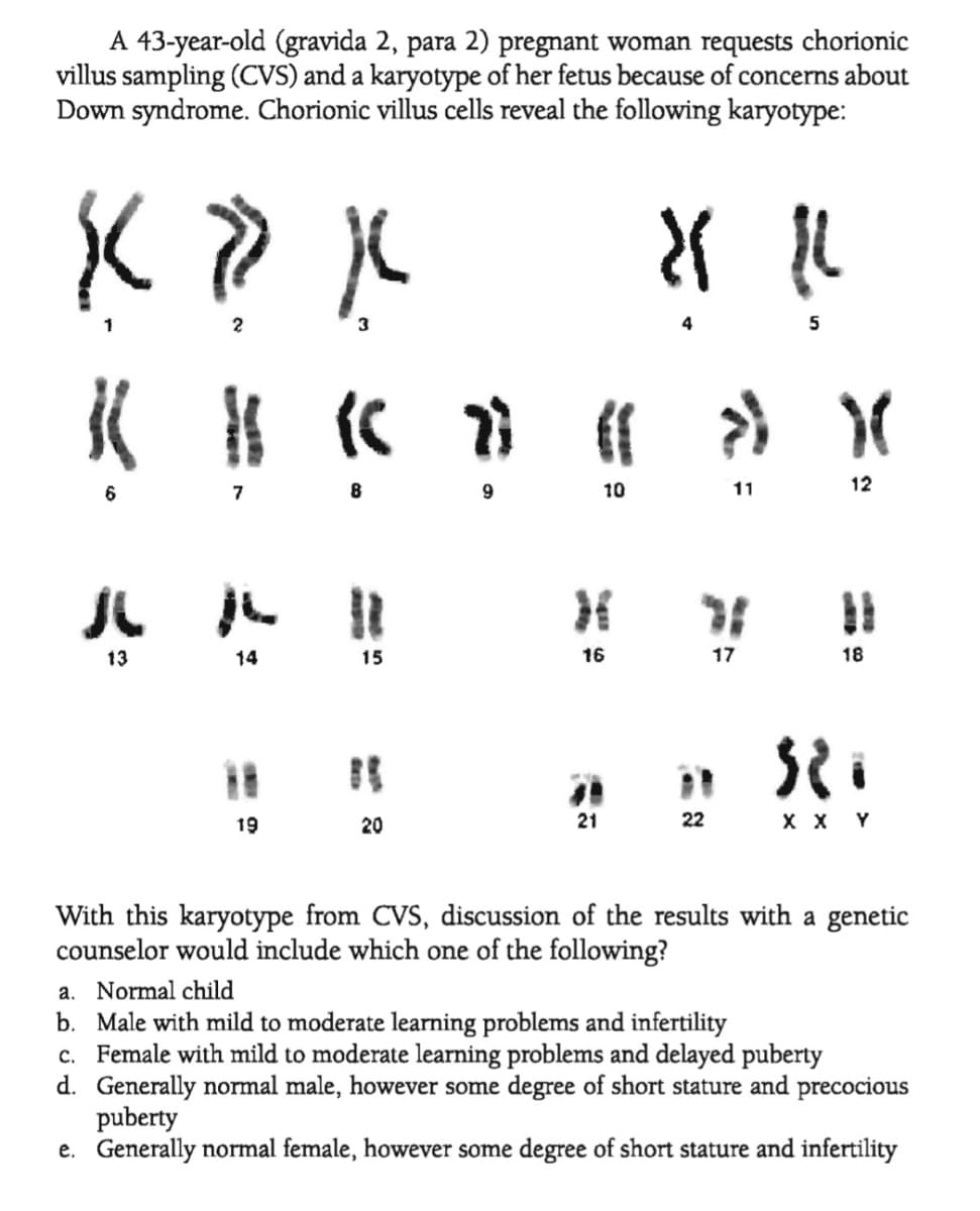 A 43-year-old (gravida 2, para 2) pregnant woman requests chorionic
villus sampling (CVS) and a karyotype of her fetus because of concerns about
Down syndrome. Chorionic villus cells reveal the following karyotype:
2
3
7
8
10
11
12
13
14
15
16
17
18
%3D
19
20
21
22
X X Y
With this karyotype from CVS, discussion of the results with a genetic
counselor would include which one of the following?
a. Normal child
b. Male with mild to moderate learning problems and infertility
c. Female with mild to moderate learning problems and delayed puberty
d. Generally normal male, however some degree of short stature and precocious
puberty
e. Generally normal female, however some degree of short stature and infertility
